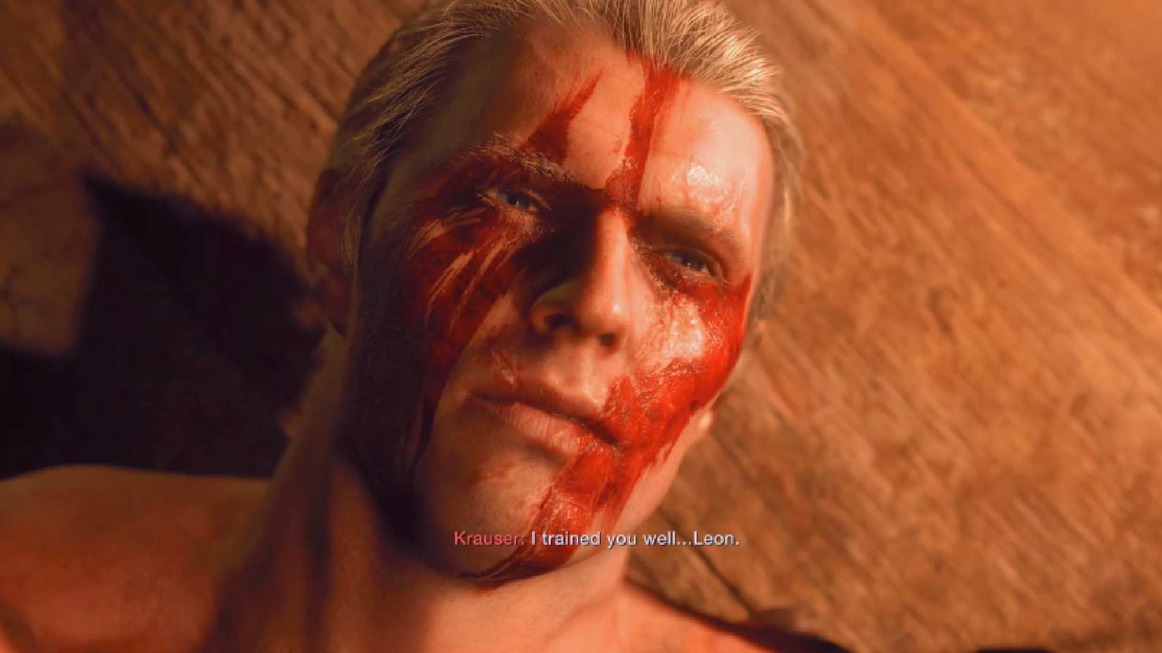 Resident Evil 4 Remake Krauser Death